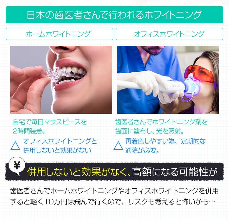 日本の歯医者さんで行われるホワイトニング